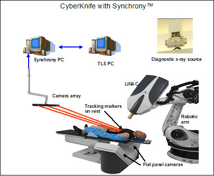 cyber knife